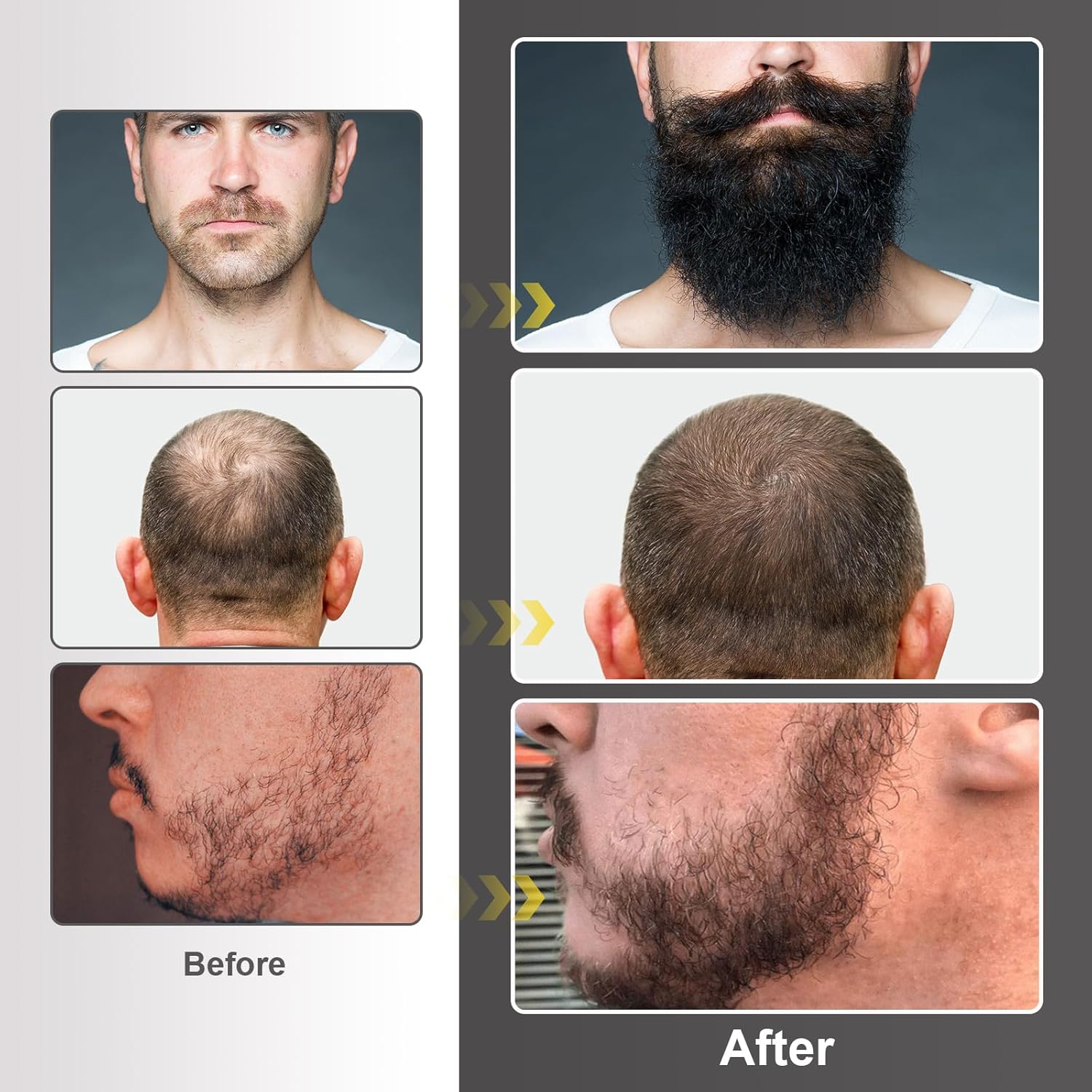 Beard Growth Kit with Beard Growth Oil (2 oz), Beard Balm and Comb T2329