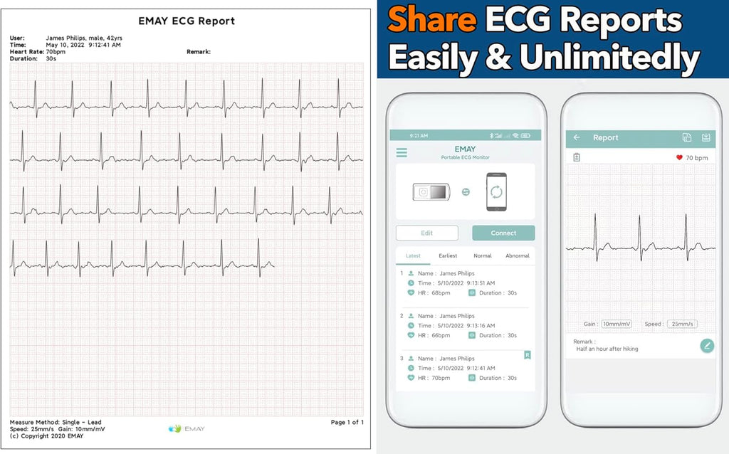 Portable ECG Monitor with LCD Screen S221263